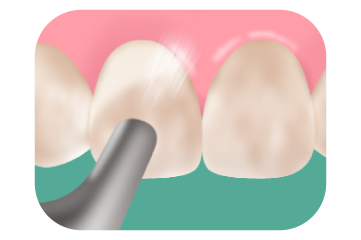 エアフロークリーニング